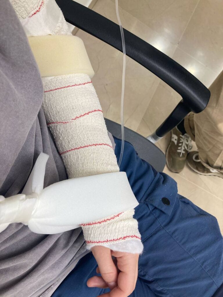 «Я поповзла в бік палаючого будинку»: поселенці розбили голову активістці